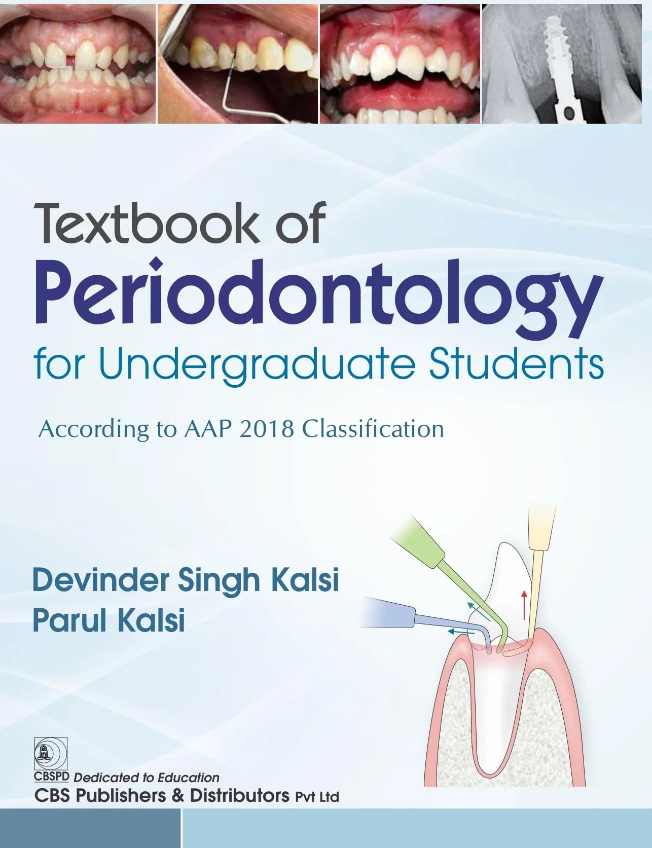 Textbook Of Periodontology For Undergraduate Students
