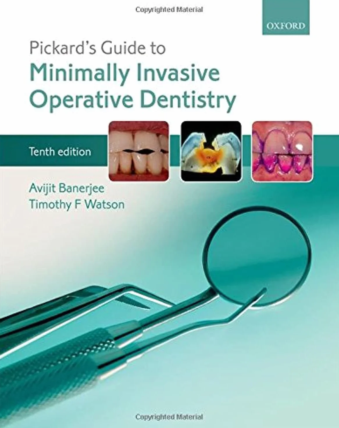 Pickard's Guide to Minimally Invasive Operative Dentistry