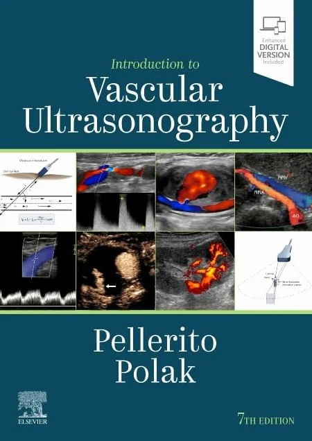 Introduction to Vascular Ultrasonography: Expert Consult Online and Print