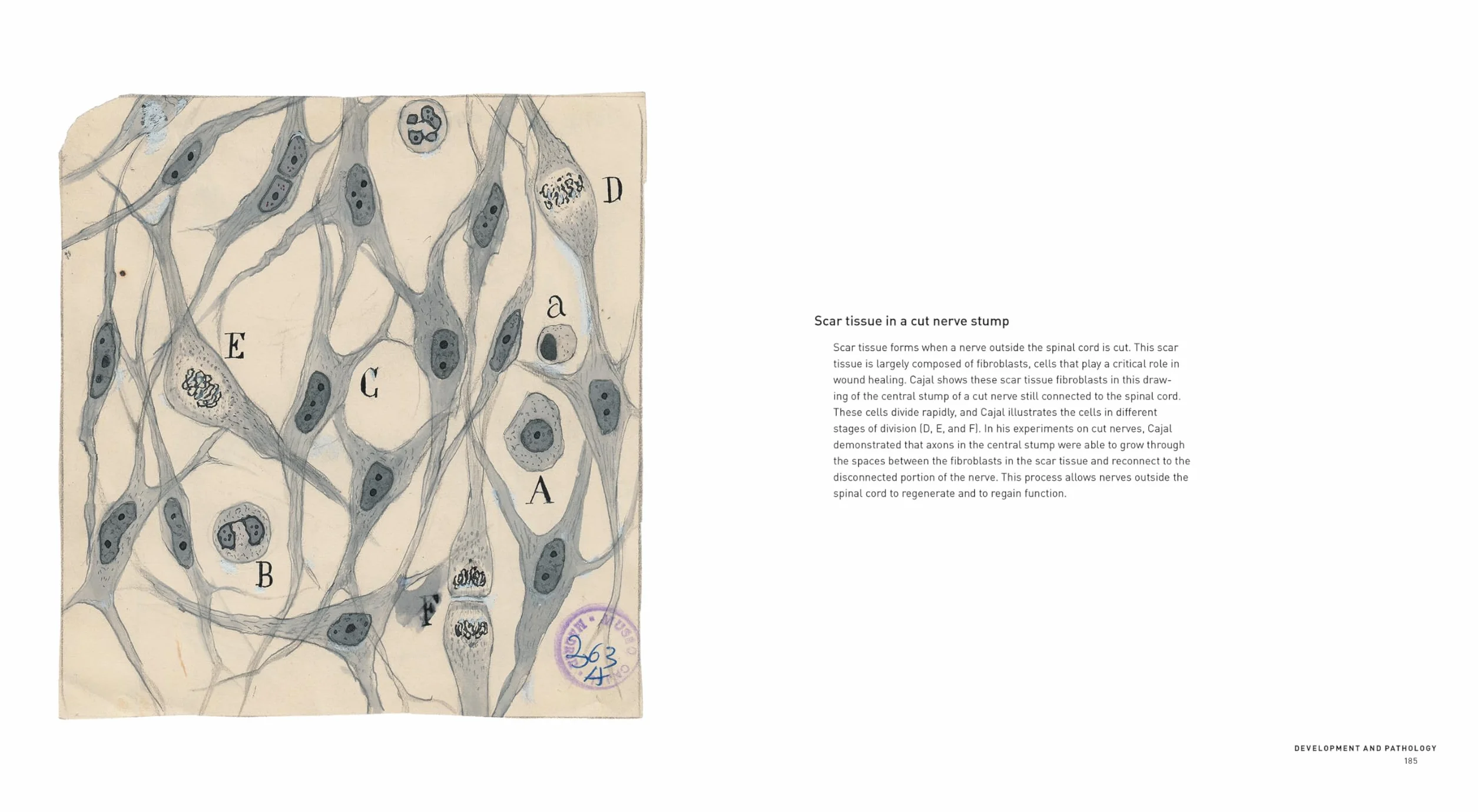 The Beautiful Brain: The Drawings of Santiago Ramon Y Cajal