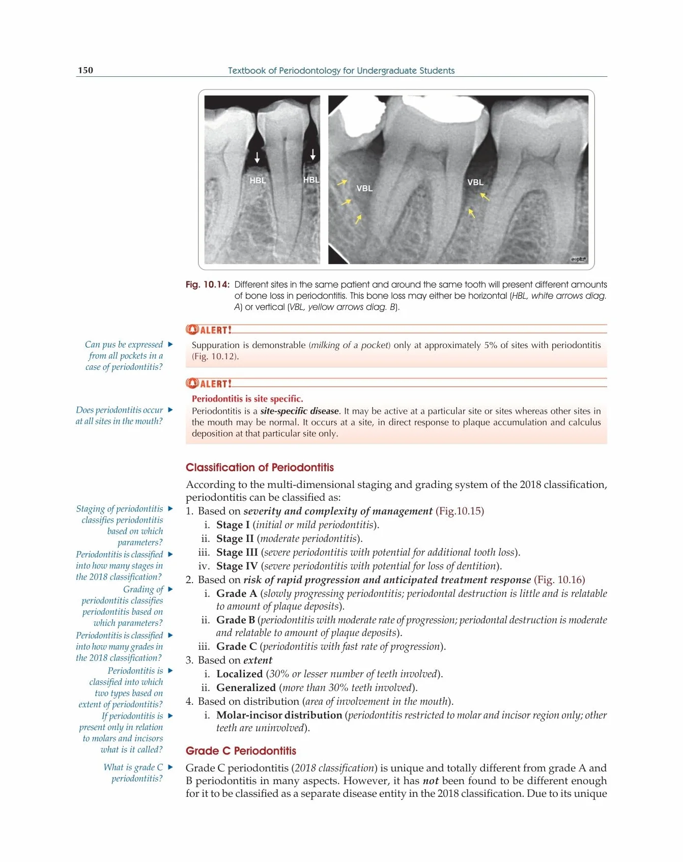 Textbook Of Periodontology For Undergraduate Students