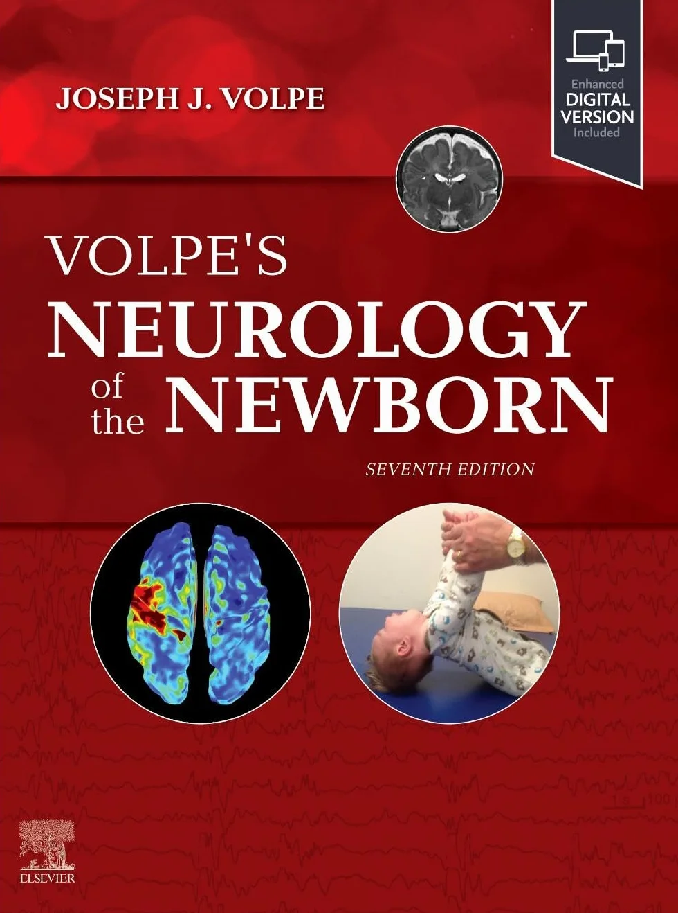 Volpe's Neurology of the Newborn