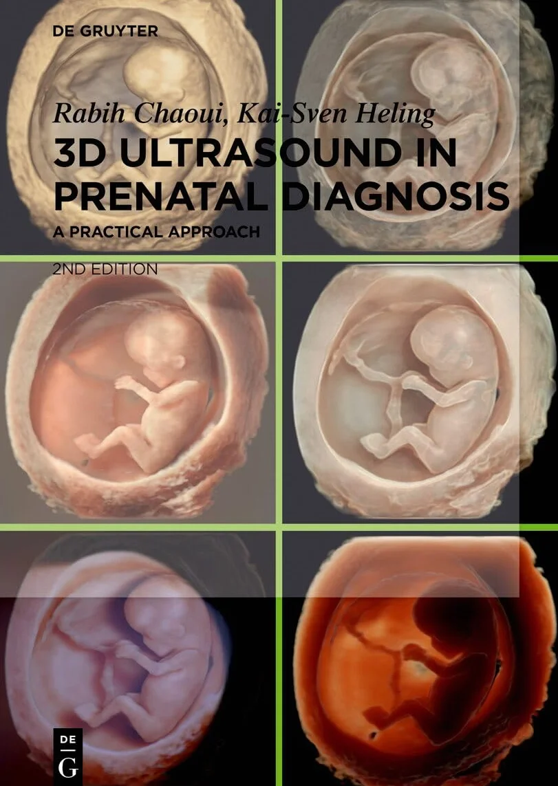3D Ultrasound in Prenatal Diagnosis: A Practical Approach