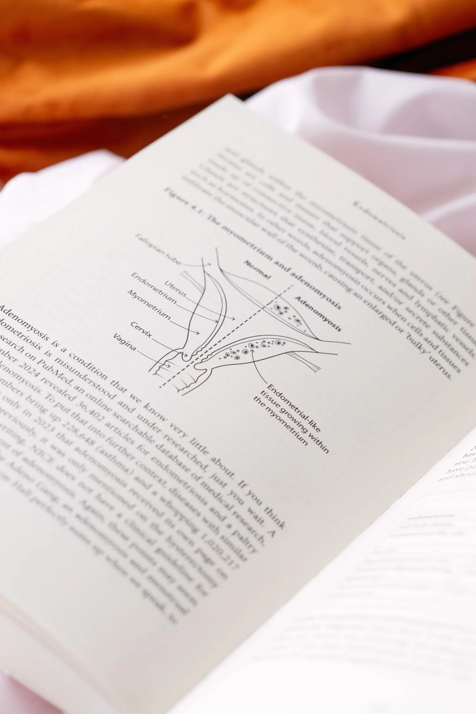 Endometriosis: Understand Symptoms, Get Treatment, Reclaim Your Life