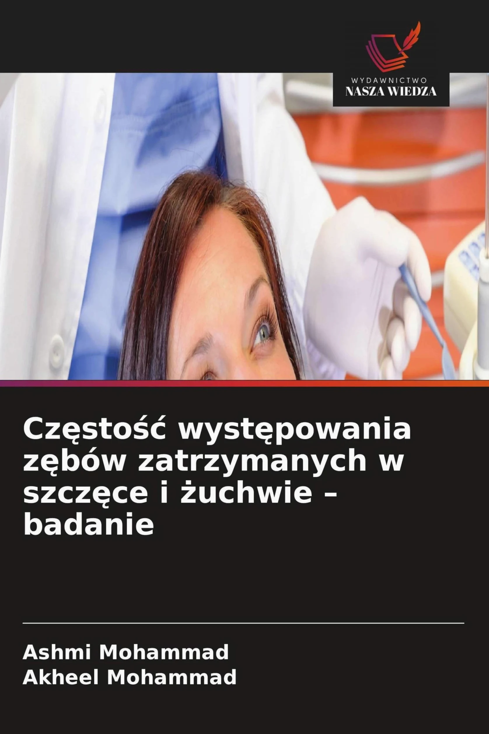 Cz¿sto¿¿ wyst¿powania z¿bów zatrzymanych w szcz¿ce i ¿uchwie - badanie